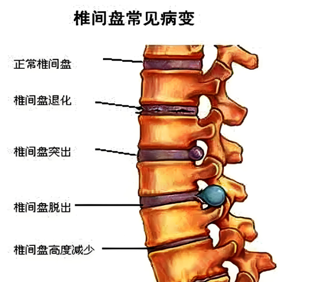 ef667f18019c1c48f977ebb81b73661e_1723619850641113.png ef667f18019c1c48f977ebb81b73661e_1723619850641113.png
